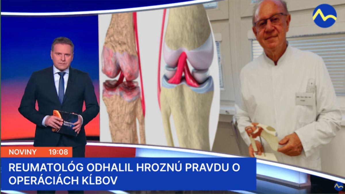 VšZP a Dôvera boli ku koncu vlaňajška v zisku, Union ZP v strate